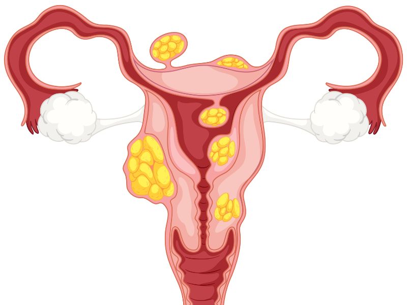 pcos & thyroid care